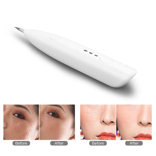 Electric Mini Laser Pen Mole Remover Pen – The perfect Mole Remover Pen for you, by S.P. Beauty
