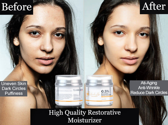 Retinol High Quality Restorative Moisturizer – The perfect Retinol for you, by S.P. Beauty