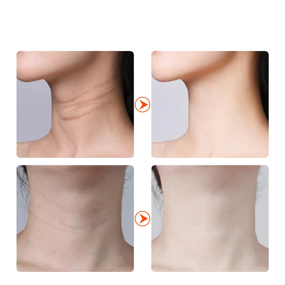 EMS Face Lifting Neck Tightening Vibrator Skin Care Red Light IPL – The perfect Massager for you, by S.P. Beauty