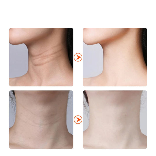 EMS Face Lifting Neck Tightening Vibrator Skin Care Red Light IPL – The perfect Massager for you, by S.P. Beauty