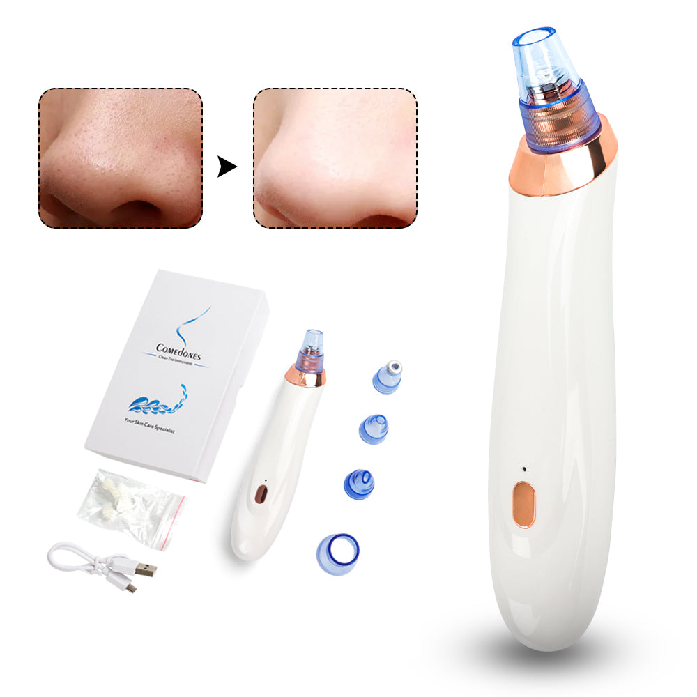 Electric Pimple Remover Blackhead Removing Apparatus – The perfect Pimple Remover for you, by S.P. Beauty